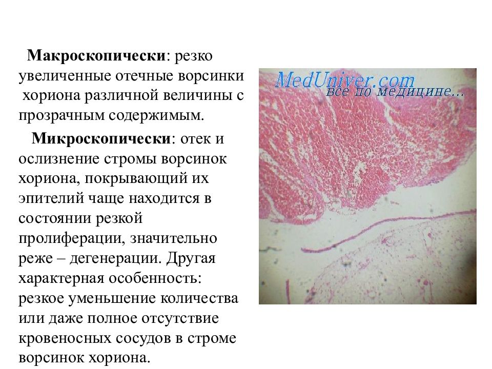 Трофобластические заболевания презентация