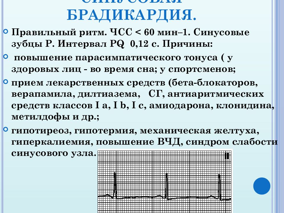 Что значит ритм сердца. Синусовая брадикардия характерна. Желудочковая брадикардия на ЭКГ. Бадигади. Бродик.