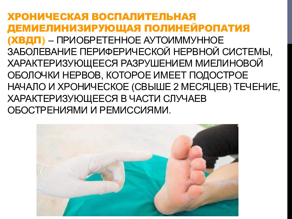 Хроническая воспалительная демиелинизирующая полинейропатия (ХВДП ) – приобретенное аутоиммунное заболевание периферической нервной системы, характеризующееся