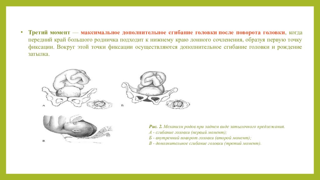 Акушерское пособие при затылочном предлежании. Задний вид затылочного предлежания биомеханизм родов. Механизм родов при переднем виде затылочного предлежания. Механизм родов при заднем виде затылочного предлежания.