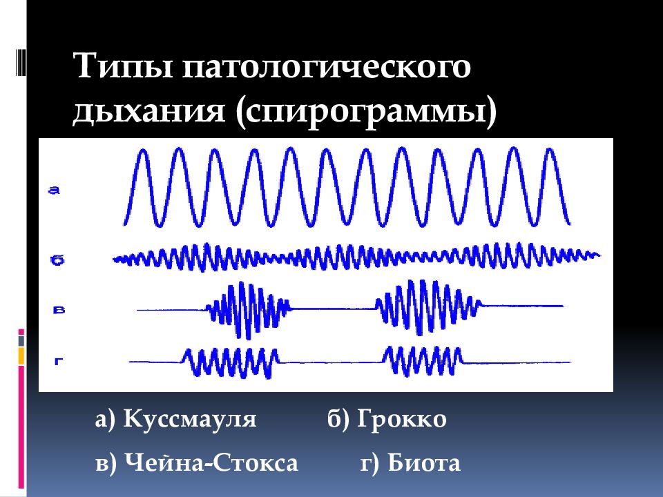 Ритм дыхания. Дыхание Биота Чейна Стокса Куссмауля. Ритмы Чейна-Стокса, Биота, Куссмауля. Дыхание Биота Чейна Стокса Грокка. Типы дыхания Куссмауля Чейна Стокса Биота.