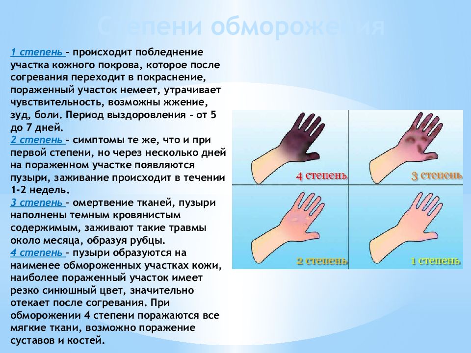 Обморожение презентация 8 класс