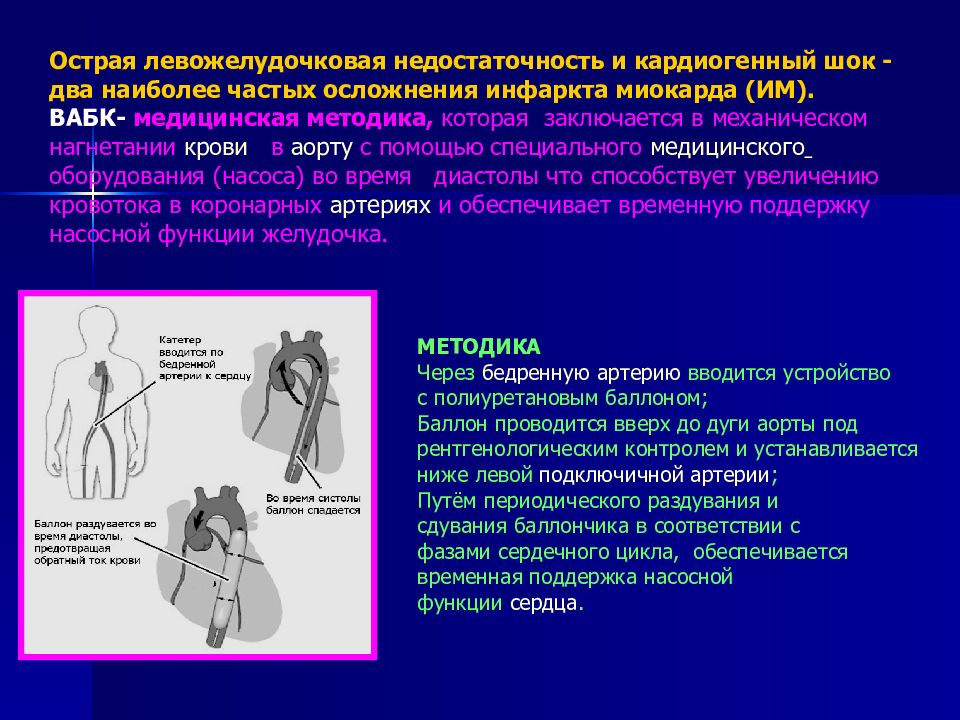 Сердечно легочная недостаточность карта вызова