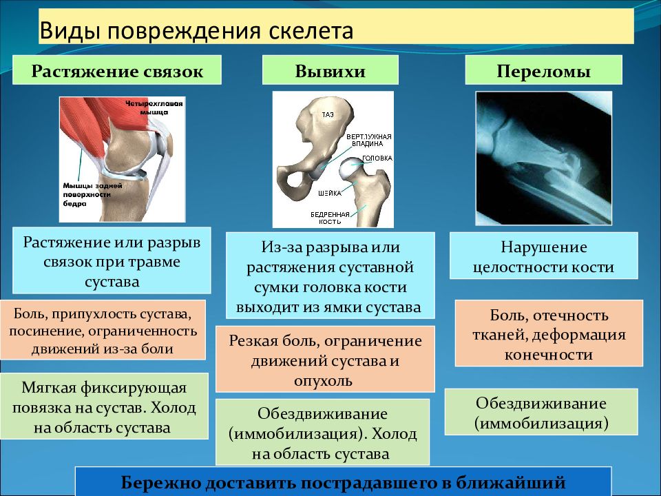 Травматология переломы презентация