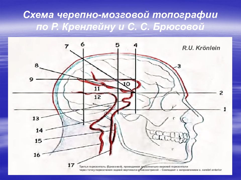 Схема служащая для ориентировки в черепно мозговой топографии