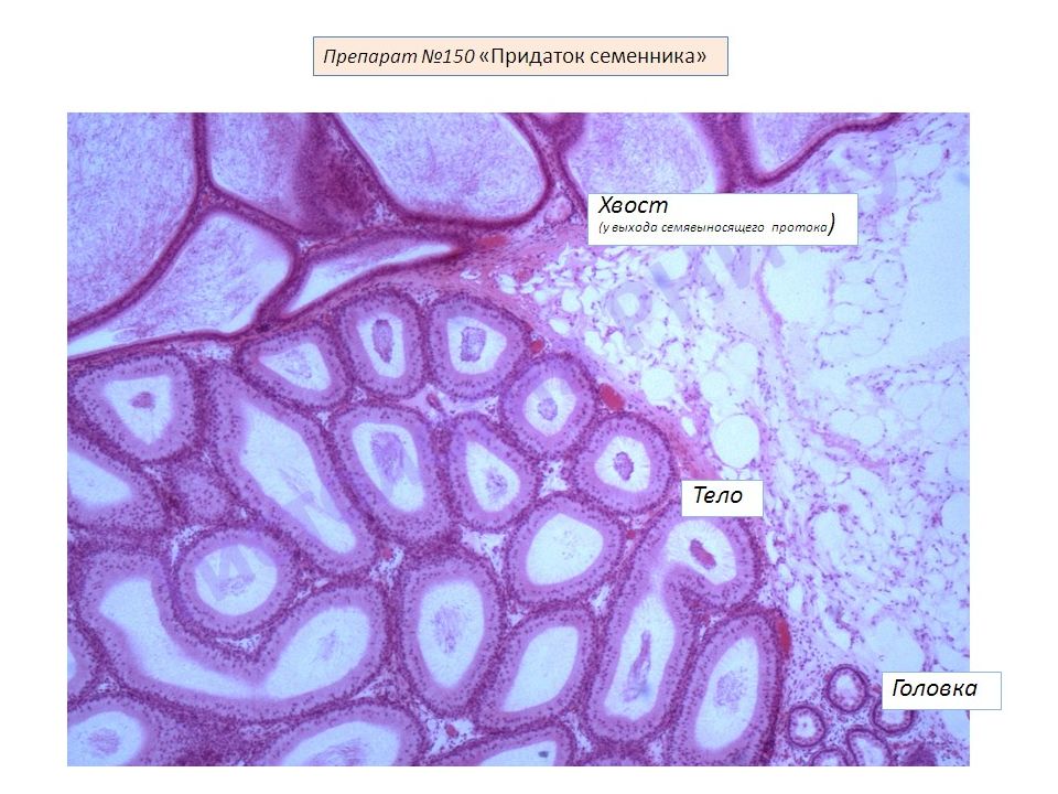 Придаток семенника рисунок гистология