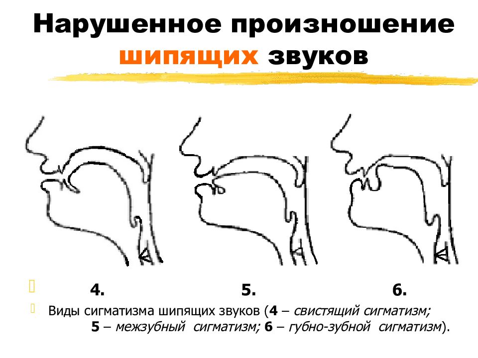 Губно зубные звуки