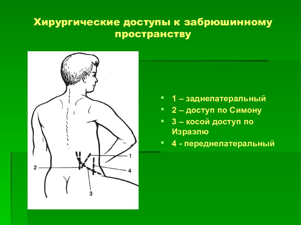 Гнойные заболевания глубоких клетчаточных пространств и железистых органов презентация