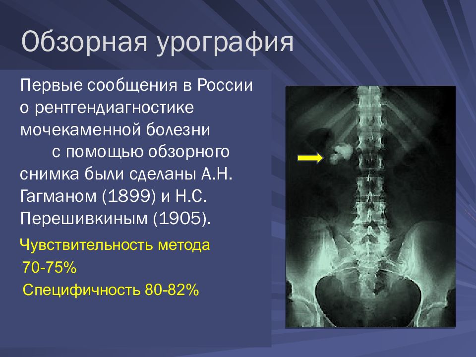 Презентация на тему урография