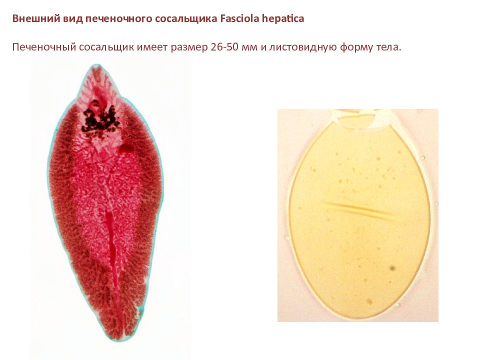 Листовидная форма червей. Трематоды Fasciola hepatica. Внешний вид печеночного сосальщика. Печёночный сосальщикпрепарат. Печёночный сосальщик внешнии вид.