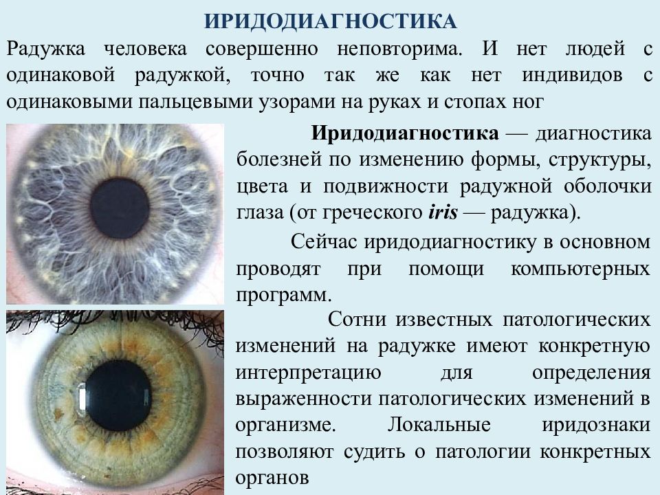 Зрачок в организме человека выполняет функцию. Иридодиагностика радужной оболочки глаза. Иридодиагностика схема радужной оболочке глаза. Диагностика по радужке глаза иридодиагностика. Радужная оболочка глаза человека.