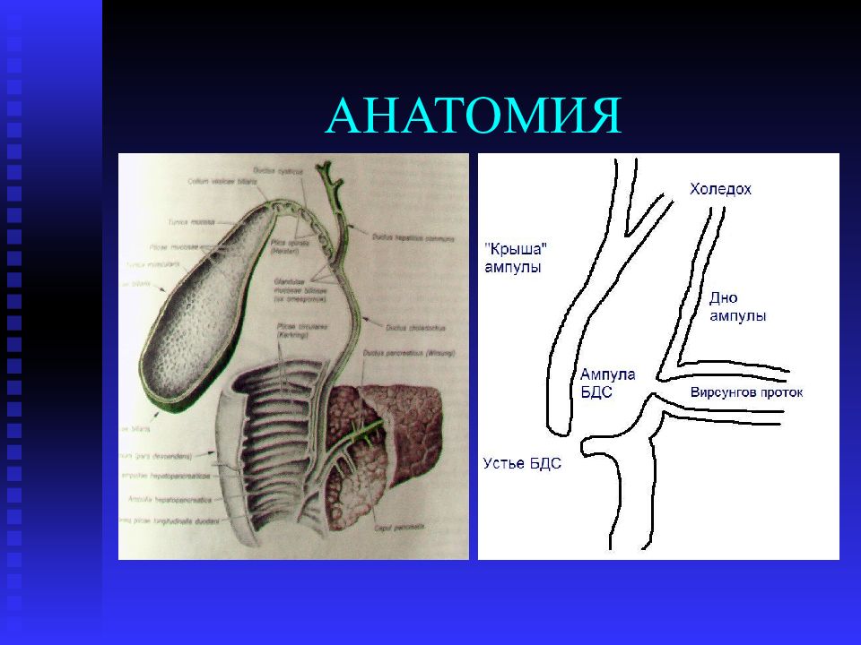 Холедох 4 мм