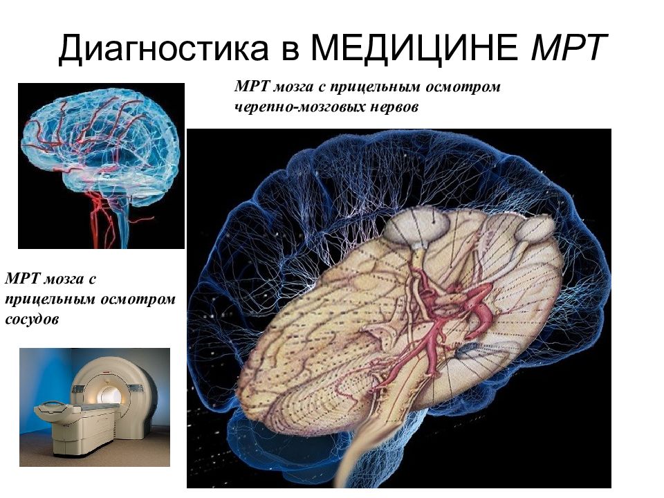 Средний мозг черепно мозговые нервы. Мрт черепно мозговых нервов. Черепно мозговые нервы мрт. Магнитный резонатор в медицине.