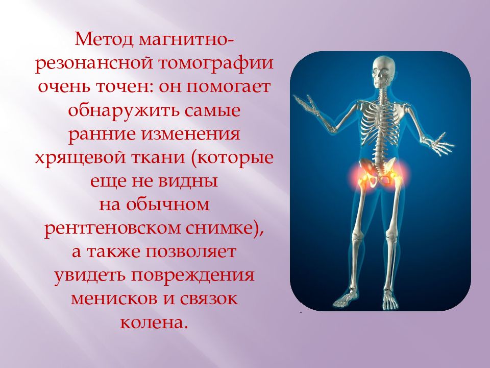 Нарушение опорно-двигательного аппарата. Поражение опорно-двигательного аппарата. Заболевания опорно-двигательного аппарата список. Лучевые методы исследования опорно-двигательного аппарата.