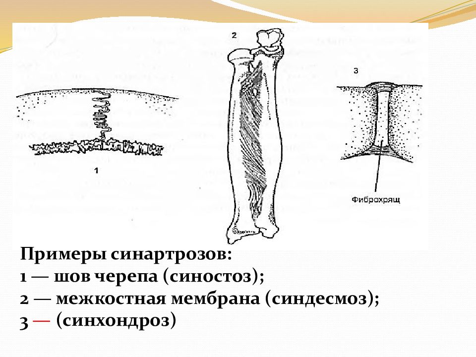 Шов кости. Синдесмозы позвоночного столба. Синхондрозы примеры. Непрерывное соединение костей синхондроз синдесмоз синостоз. Синдесмозы синхондрозы и синостозы черепа.