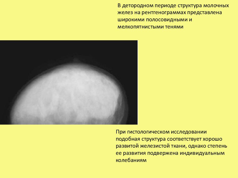 Схема обследования молочной железы у женщин