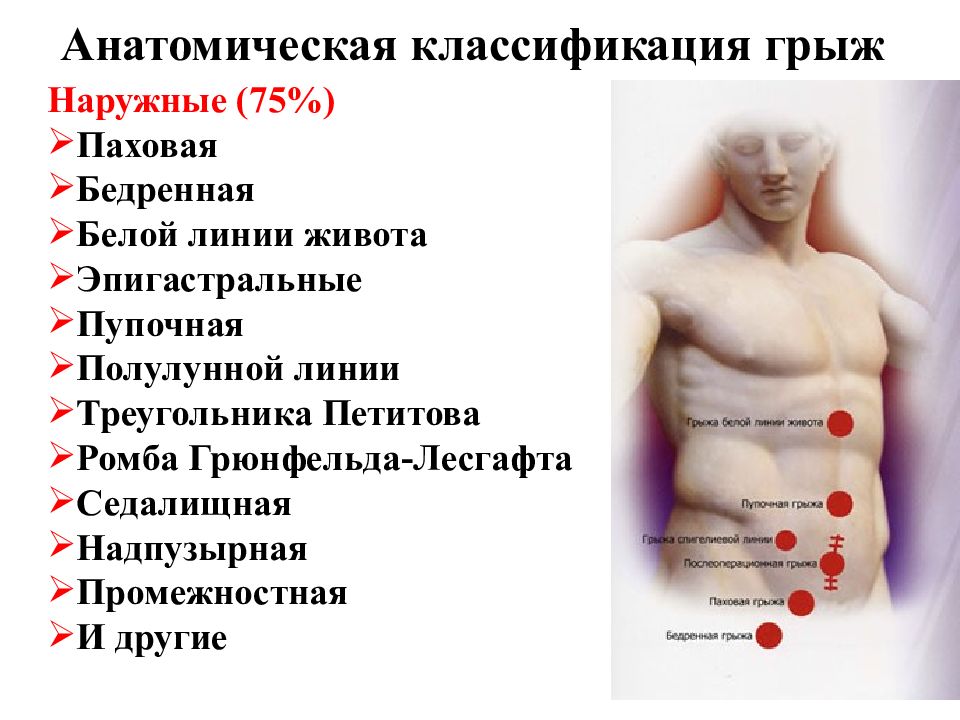 Грыжа казакша презентация