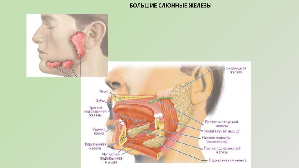 Слюнные железы. Воспаление протоков подчелюстной слюнной железы. Операция околоушной слюнной железы. Выводной проток подчелюстной слюнной железы (1500). Обтурация протока слюнной железы.