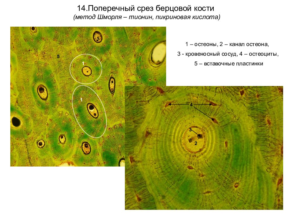 Продольный срез трубчатой кости рисунок