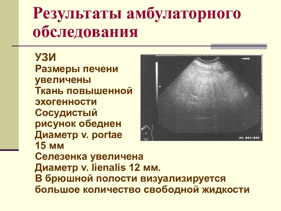 Усиление сосудистого рисунка печени у ребенка