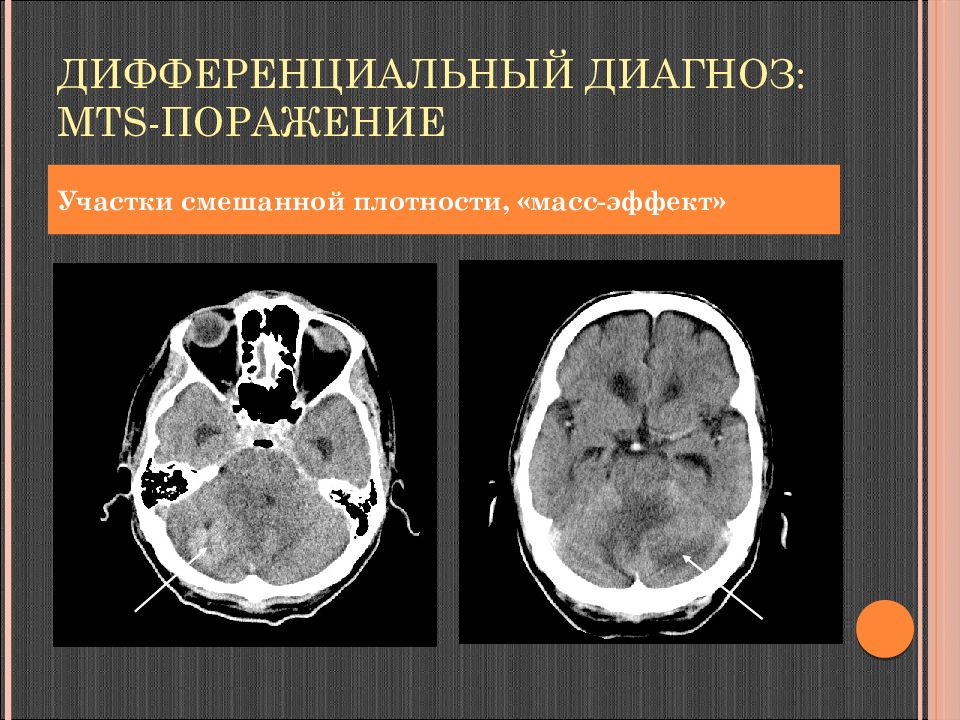 Мрт дифференциальная диагностика