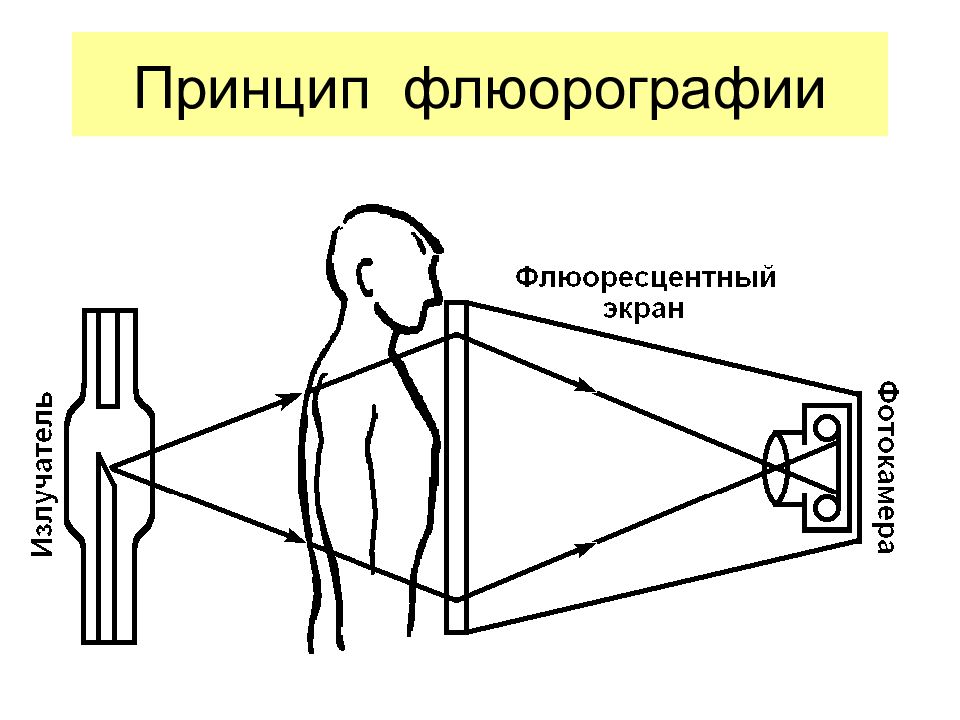 Методика получения рентгеновского изображения