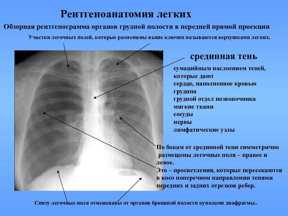 Негативное изображение рентген