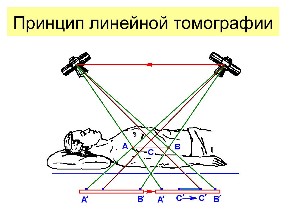 Метод получения изображения. Линейная томография принцип. Линейная рентгеновская томография. Линейная томография принцип метода. Схема рентгеновского компьютерного томографа.