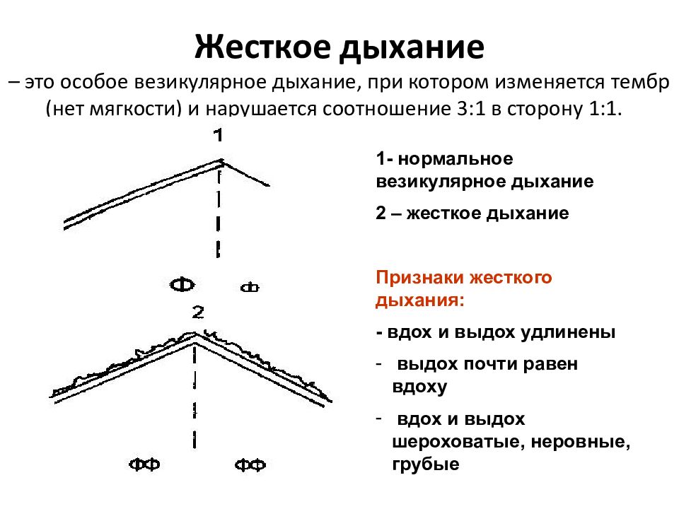 Кашель жесткое дыхание