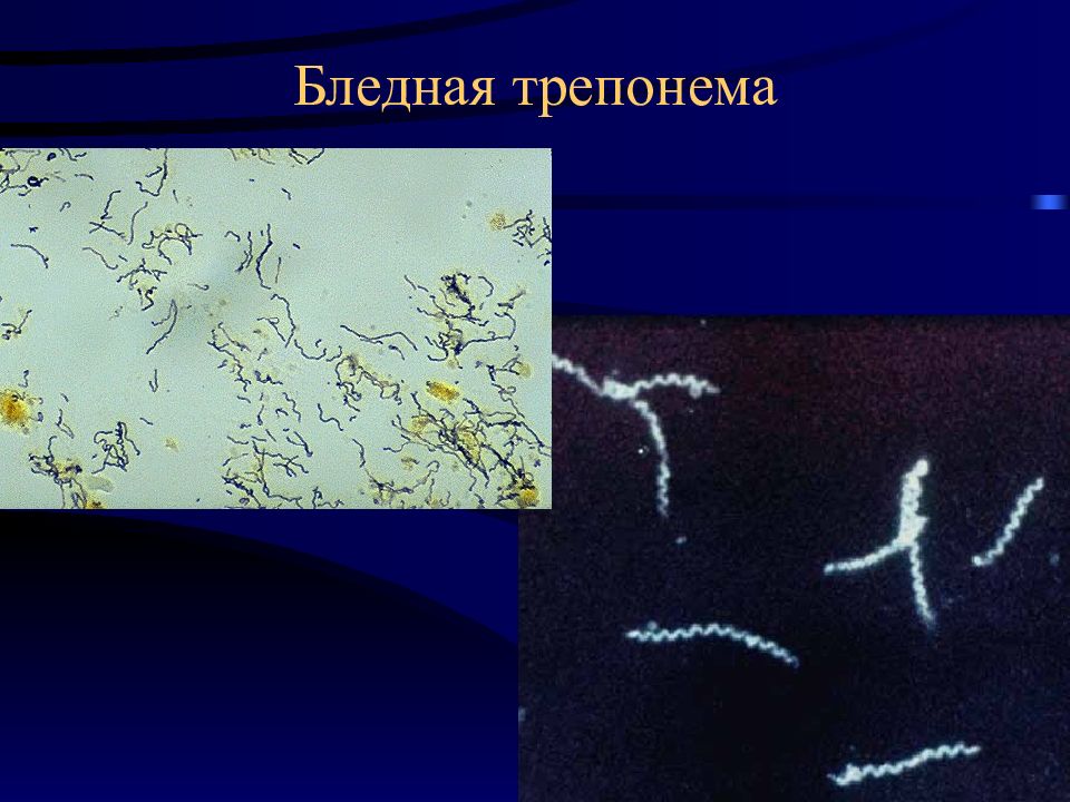 Бледная трепонема treponema pallidum. Трепонема паллидум микроскопия. Спирохета бледная трепонема.