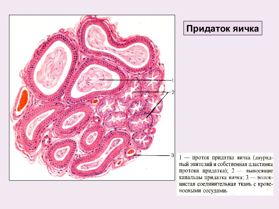 Придаток яичка рисунок