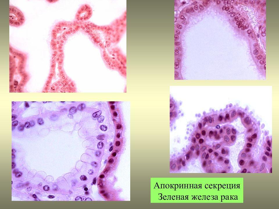 Зеленая железа. Железистый эпителий апокриновая секреция. Железистый эпителий. Антеннальная (зеленая) железа речного рака.. Препарат железистый эпителий апокриновая секреция. Апокриновая секреция гистология.