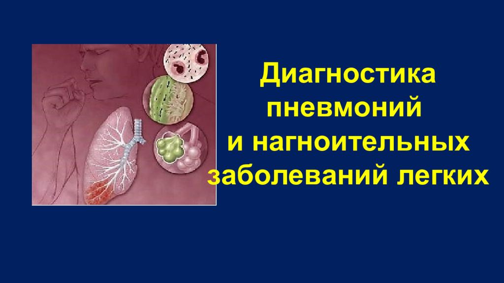 Диагностика пневмоний и нагноительных заболеваний легких