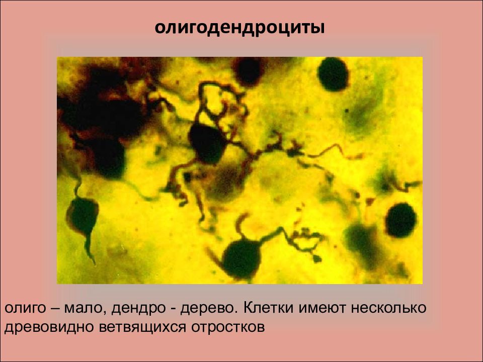 Может иметь несколько ядер. Клетки имеют отростки. Общая морфофункциональная характеристика клетки.