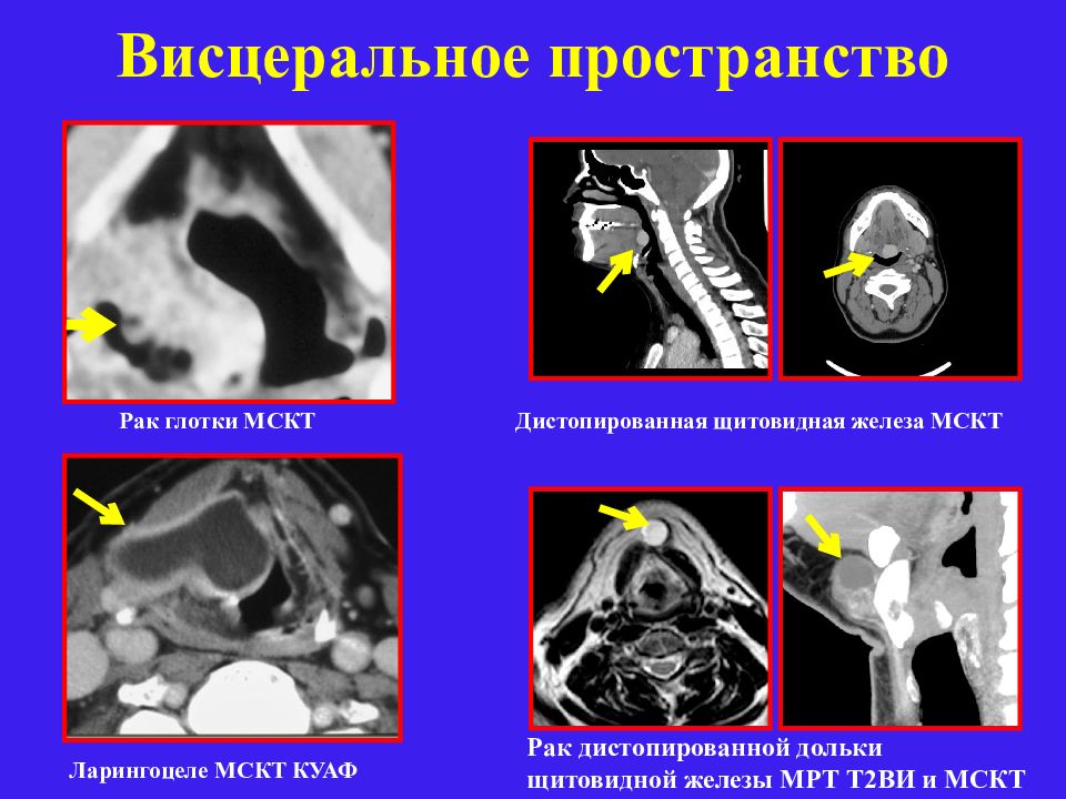 Что означает кт