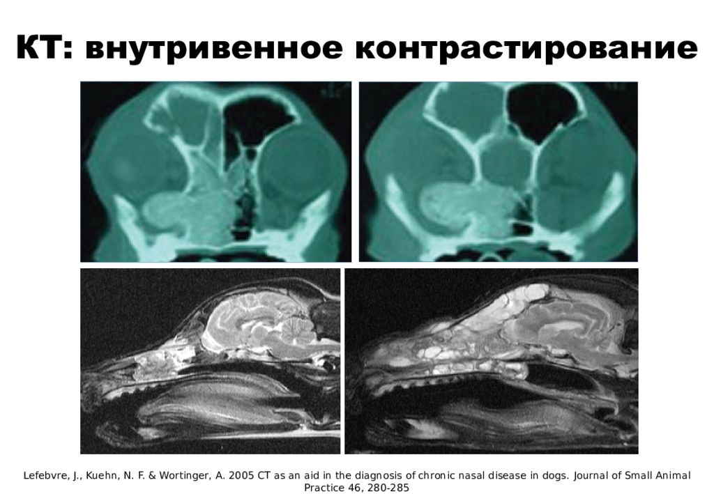 Мрт контрастирование. Кт с внутривенным контрастированием. Кт с внутривенным контрастированием. Кт с внутривенным контрастированием. Отсроченная фаза контрастирования при кт.