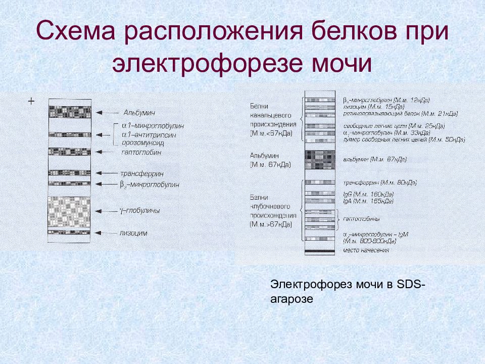 Электрофорез белков. Электрофорез белков сыворотки крови с иммунофиксацией. Электрофорез белков мочи. Белковый электрофорез. Схема электрофореза белков.