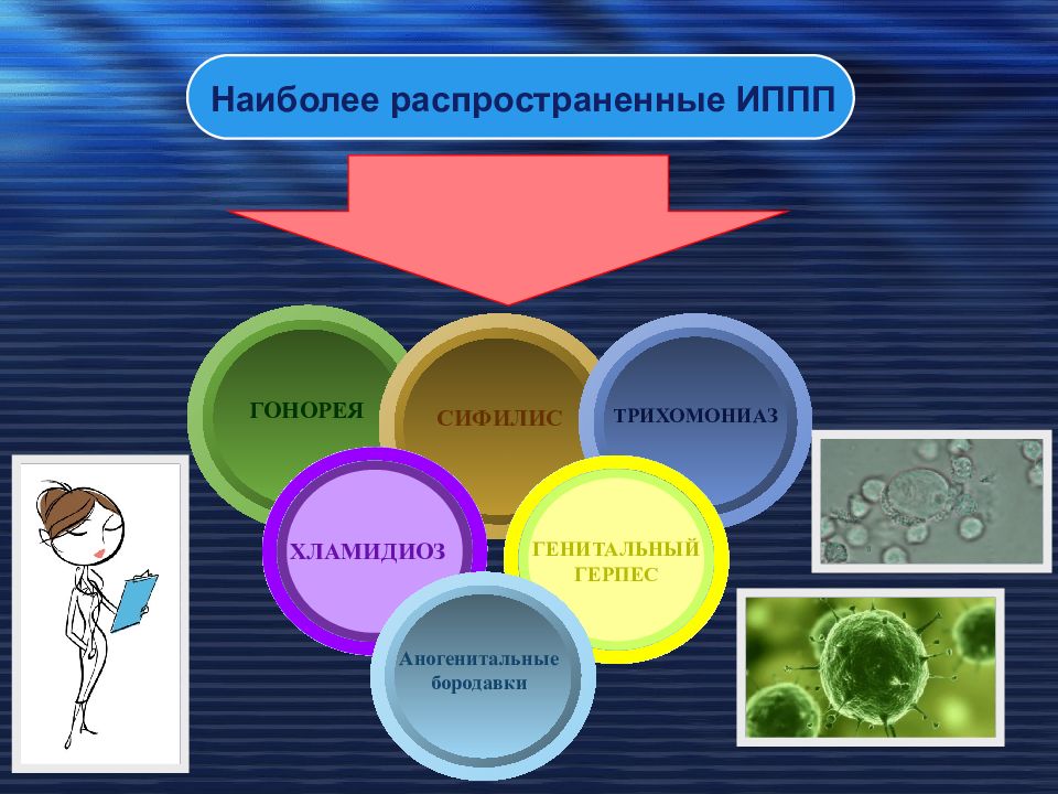 Заболевания передающиеся пол путем картинки