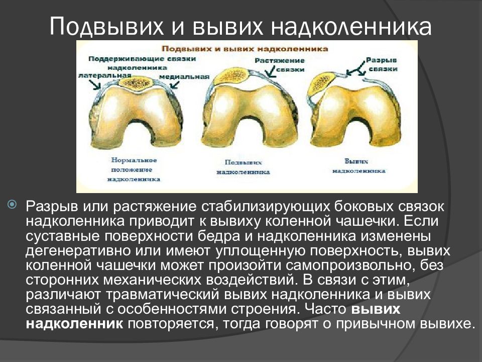 Повреждения и заболевания коленного сустава презентация