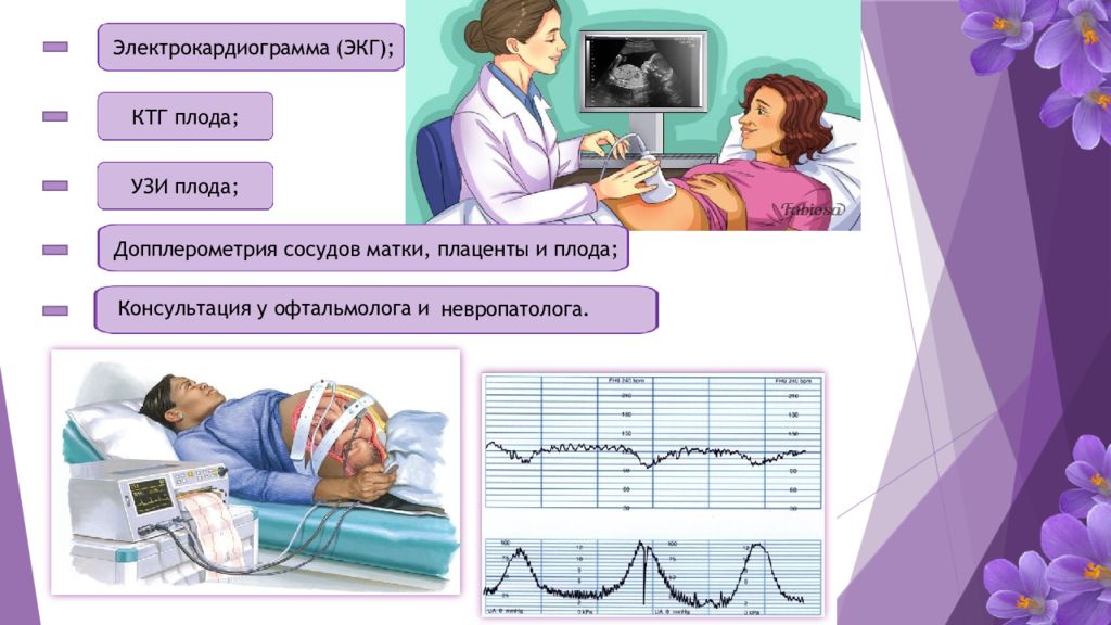 Преэклампсия беременных презентация