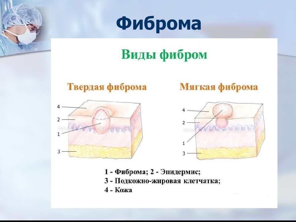 Тело мягкое на ощупь. Твердая и мягкая фиброма.