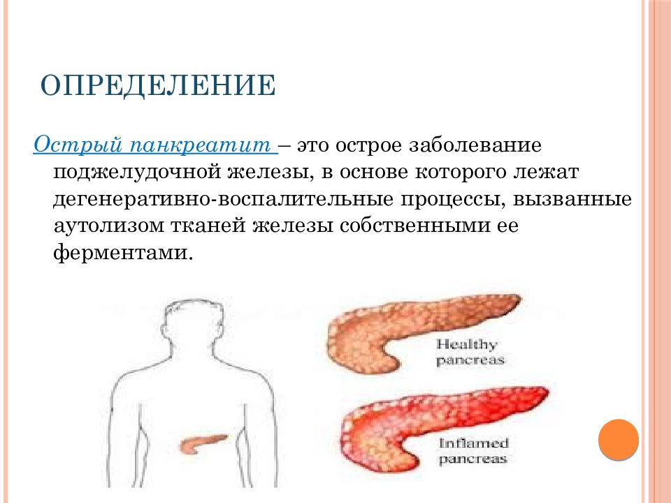 Острый и хронический панкреатит презентация