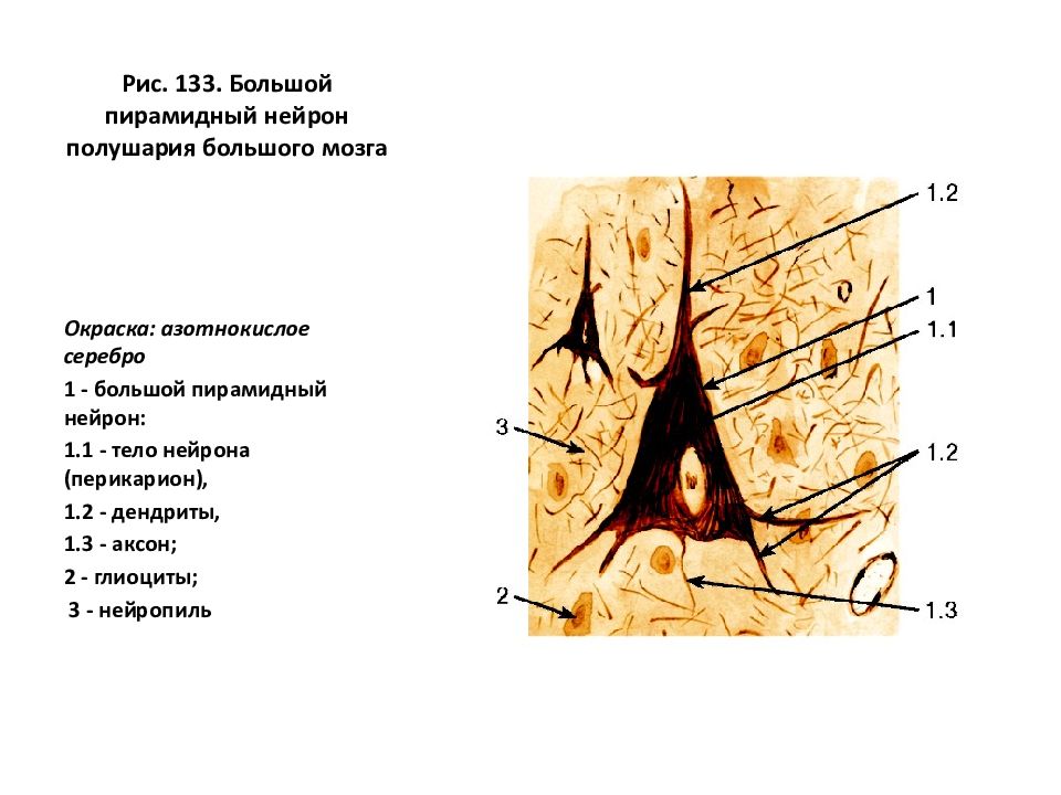 Клетки беца. Пирамидальный Нейрон гистология. Гигантские пирамидные Нейроны Беца. Пирамидный Нейрон (клетка Беца).. Большой пирамидальный Нейрон гистология препарат.