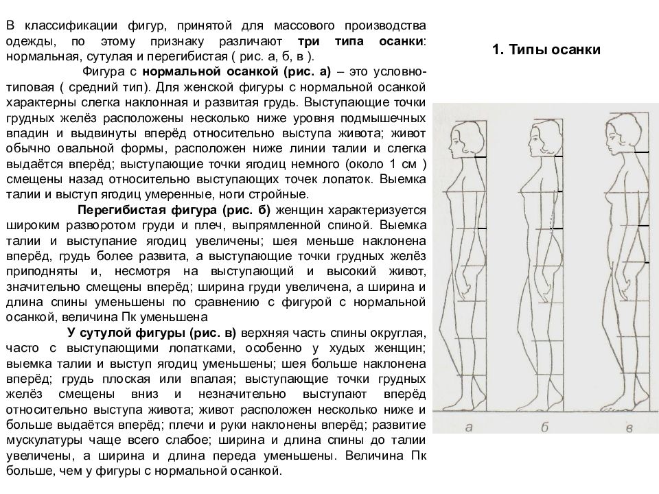 Осанка фигуры. Типы фигур перегибистая, нормальная, сутулая. Типы осанки перегибестая. Осанки женской фигуры. Осанки фигуры человека.