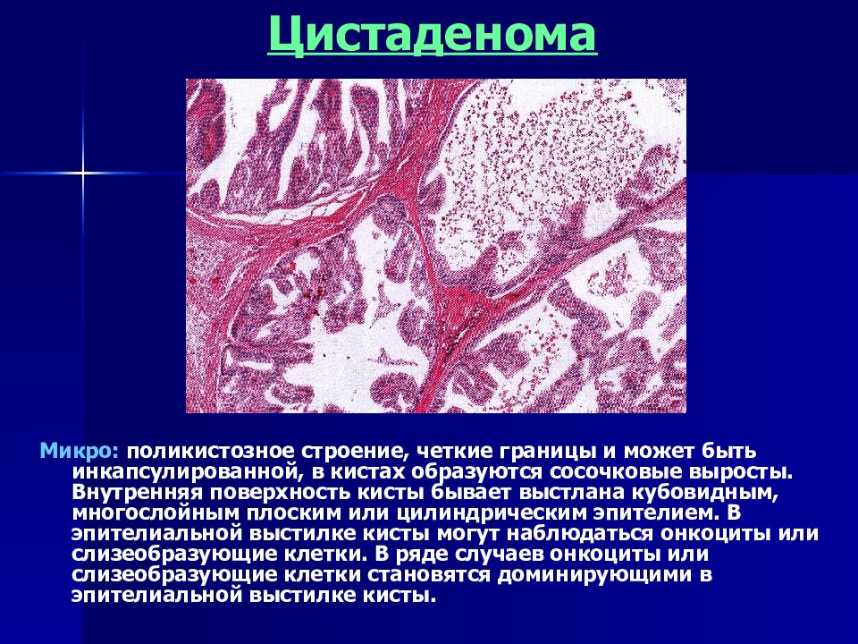 Реактивно дистрофические заболевания слюнных желез презентация