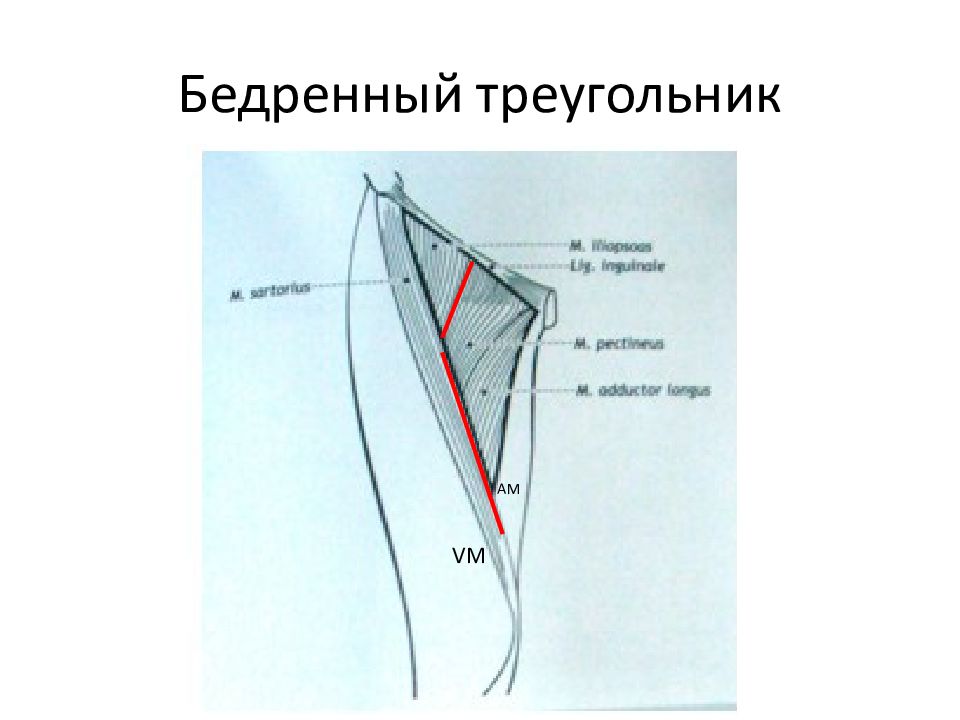 Бедренный треугольник. Бедренный треугольник анатомия. Бедренный треугольник топография. Границы бедренного треугольника. Бедренный треугольник сосуды.