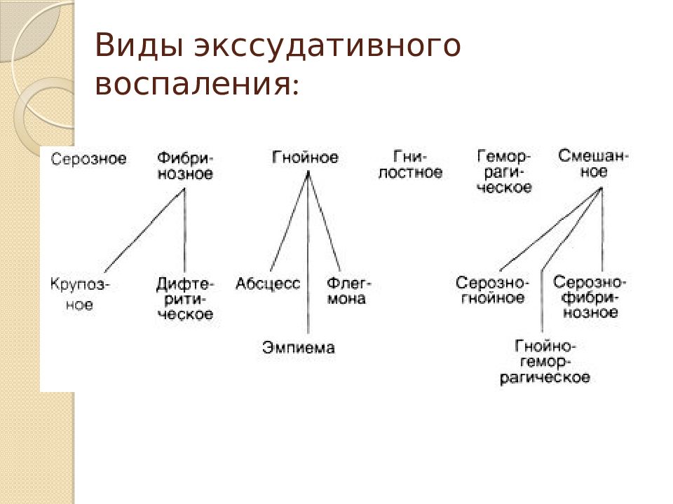 Виды воспаления. Экссудативное воспаление блок схема. Классификация экссудативного воспаления. Классификация экссудативного воспаления таблица. Формы экссудативного воспаления.