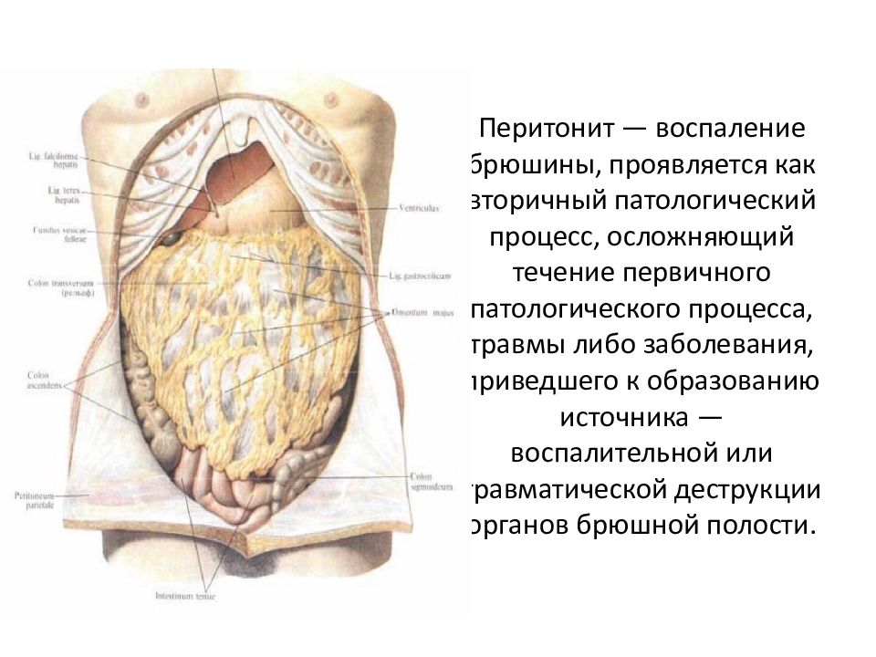 Перитонит что это симптомы у взрослого