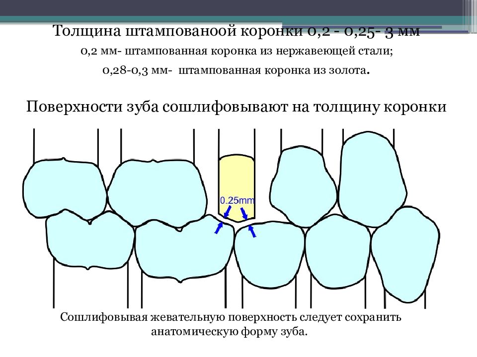 Штампованные коронки презентация