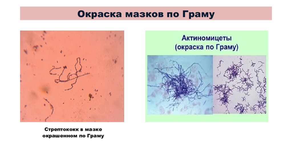 Клетка метод окраски. Актиномицеты окраска по методу грама. Актиномицеты окрашивание по Граму. Микроскопический метод исследования изучения морфологии бактерий. Актиномицеты окраска по Граму цвет.